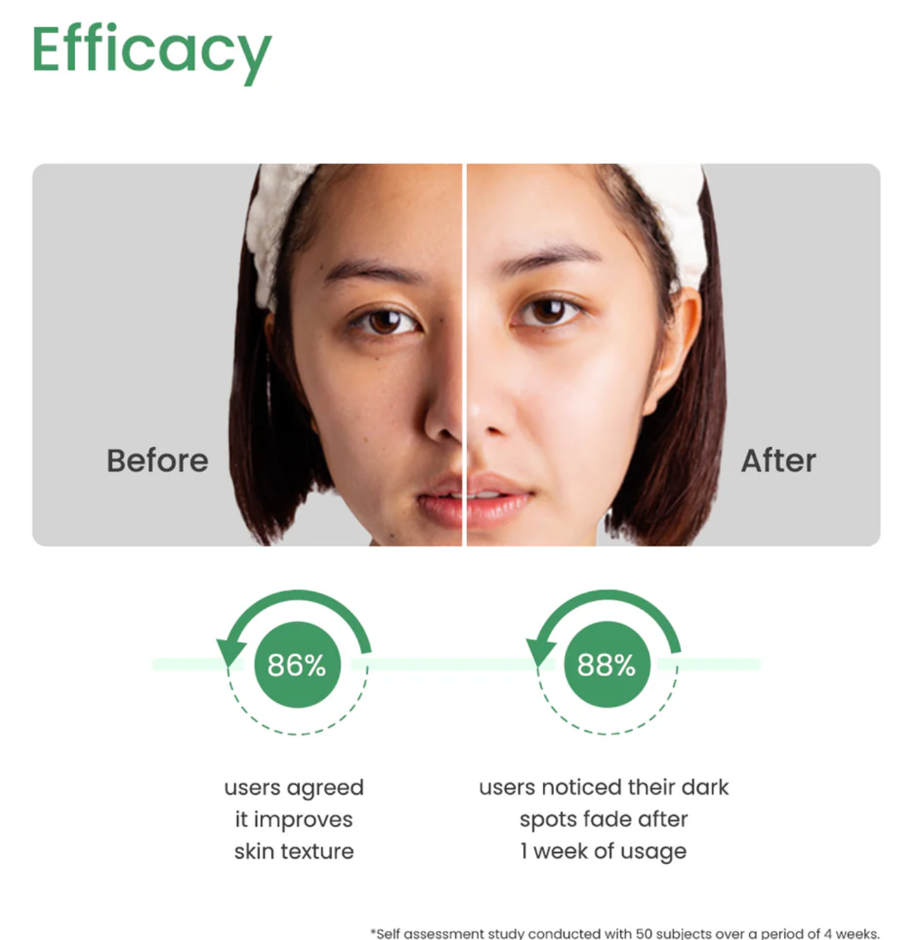 10% Azelaic Acid Face Serum