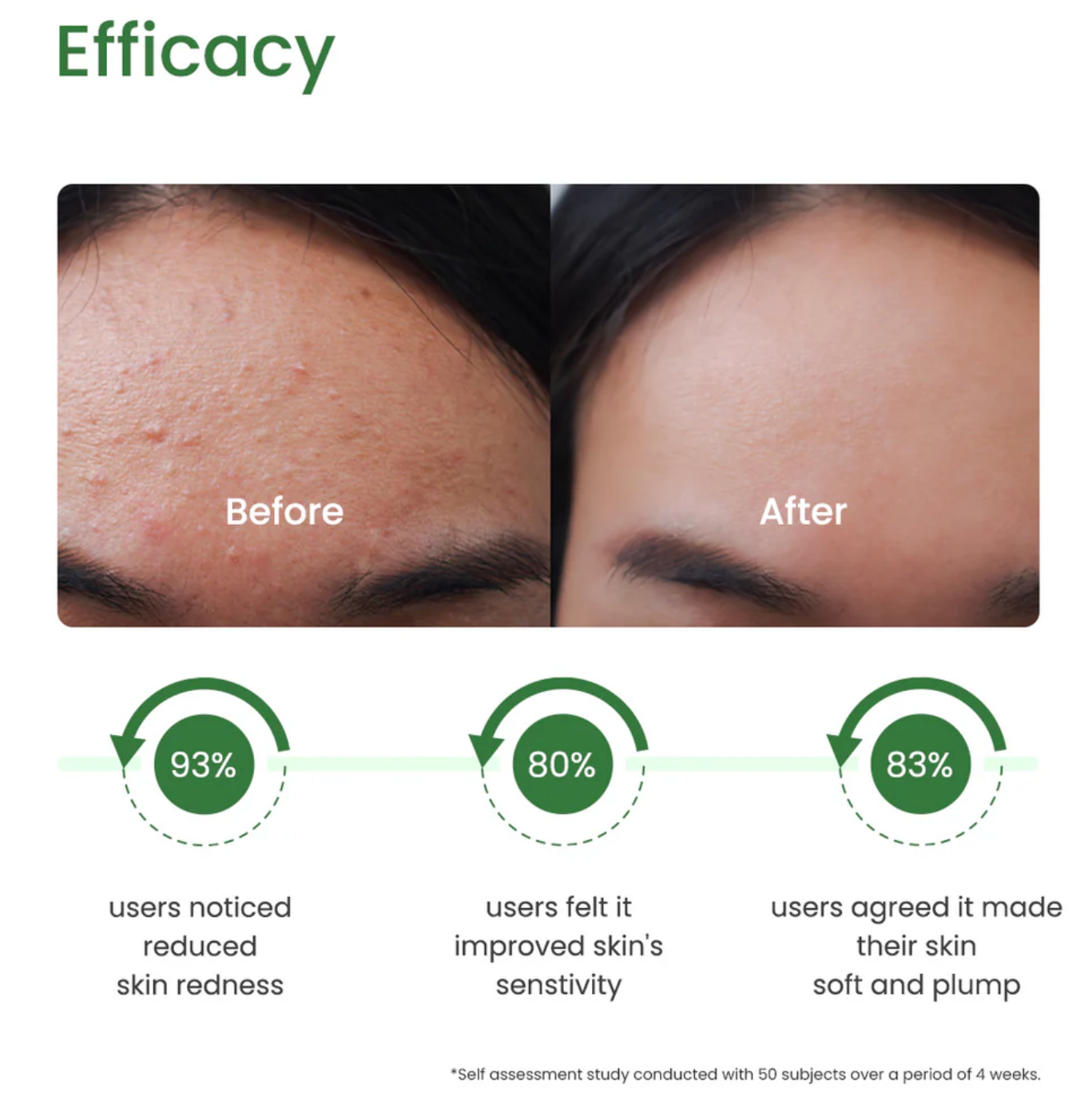 Photo Gel with Centella Asiatica and Horsetail Extract